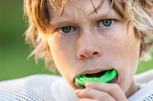 Keep Your Winning Smile: Wear An Athletic Mouthguard