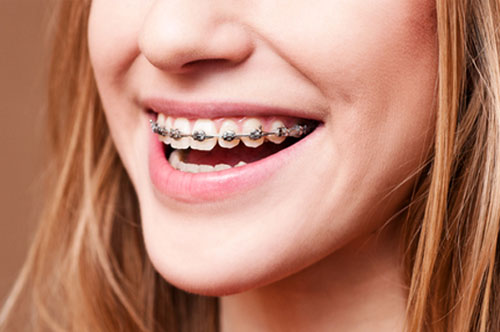Orthodontics Can Improve Your Smile & Quality of Life